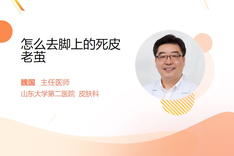 怎么去脚上的死皮老茧